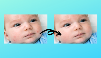 Photo Retouching Remove Blemishes & Pimples
